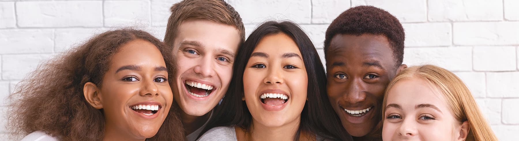 SureSmile Before And After Dr Mariana Orthodontics Monroe WA