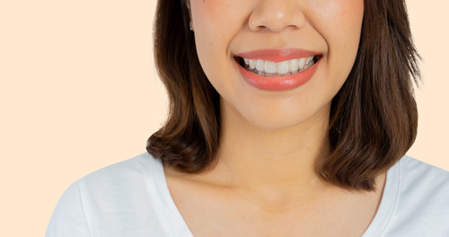 Reasons to Pursue Braces as an Adult - Dr. Mariana can Help You Decide What is Right for You