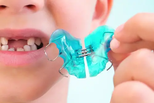 Common Orthodontic Appliances for Kids - Dr. Mariana Shows You What is Best for Your Child