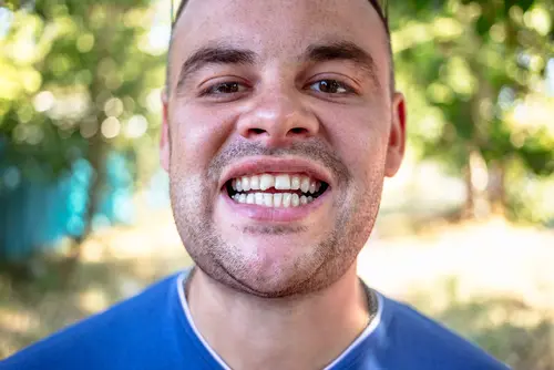 Dangers of Not Wearing Mouthguards - Mariana Orthodontics Explains Why They Are Important