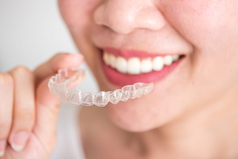 What Makes Invisalign So Great - Mariana Orthodontics