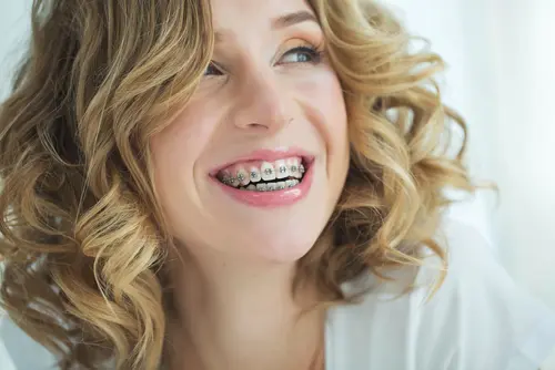 Braces for Adults - Dr. Mariana Orthodontics