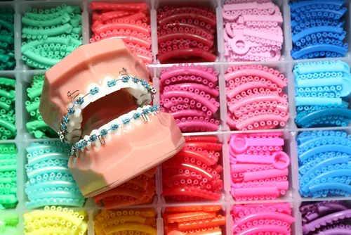 Color My Braces - Dr. Mariana Orthodontics
