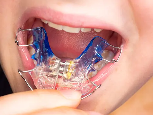 Phase One Orthodontics - Dr. Mariana is there to Help