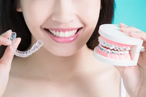 Types of Braces - Which is Right for You with Mariana Orthodontics